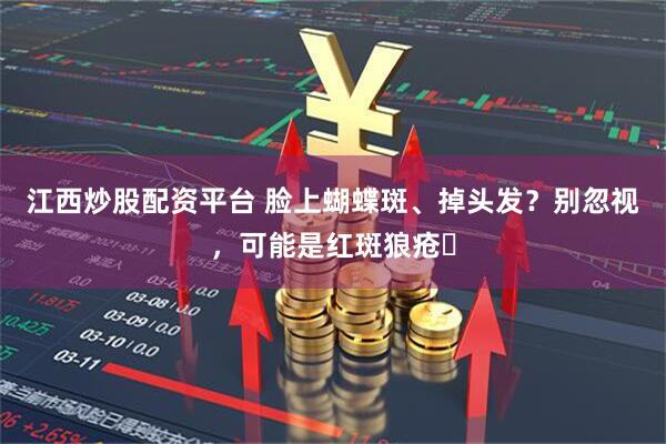 江西炒股配资平台 脸上蝴蝶斑、掉头发？别忽视，可能是红斑狼疮️